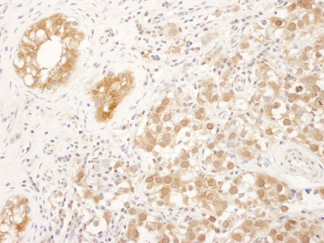 FNTA Antibody in Immunohistochemistry (IHC)