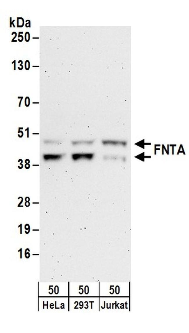 FNTA Antibody in Western Blot (WB)