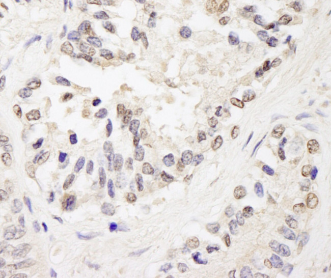 FOG1/ZFPM1 Antibody in Immunohistochemistry (IHC)