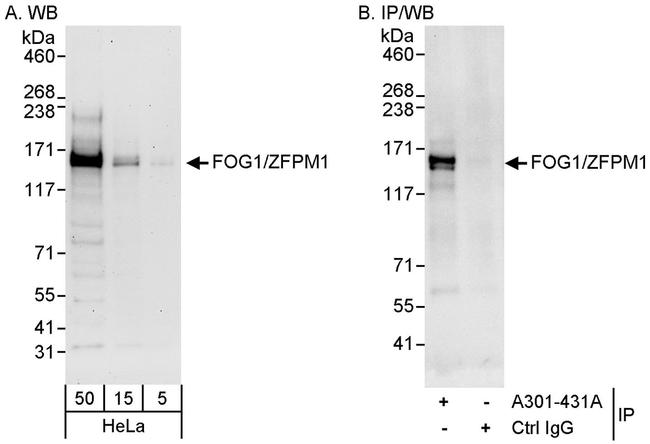 FOG1/ZFPM1 Antibody in Western Blot (WB)
