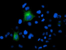 FOLH1 Antibody in Immunocytochemistry (ICC/IF)