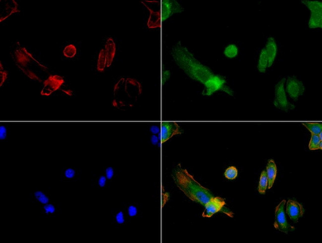 FOLH1 Antibody in Immunocytochemistry (ICC/IF)