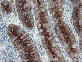 FOLH1 Antibody in Immunohistochemistry (Paraffin) (IHC (P))