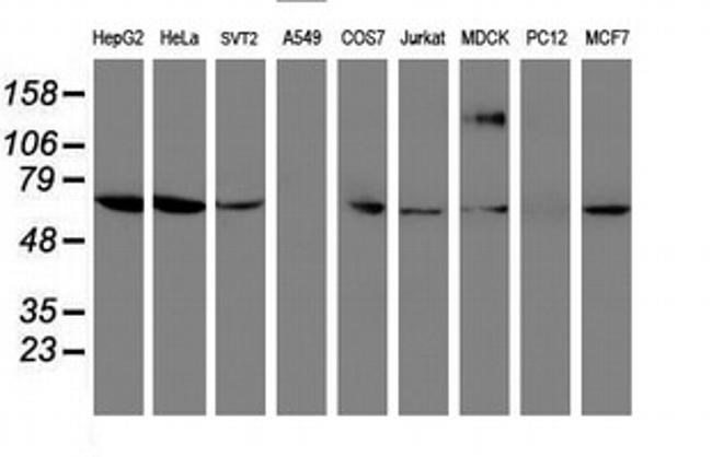 FOLH1 Antibody in Western Blot (WB)