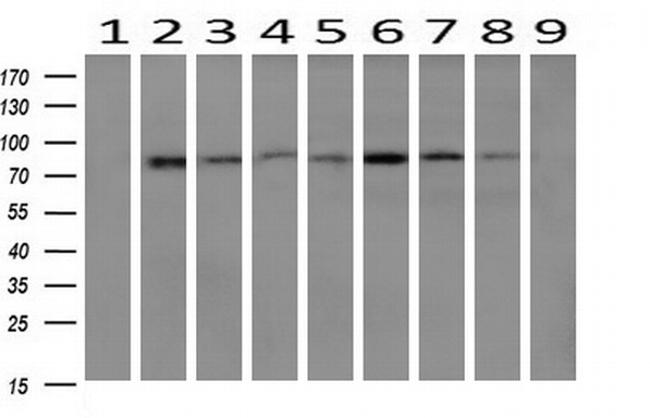 FOLH1 Antibody in Western Blot (WB)