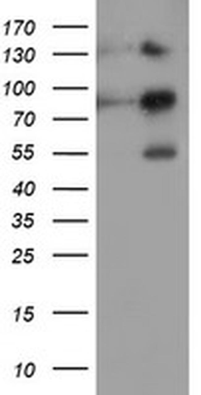 FOLH1 Antibody in Western Blot (WB)