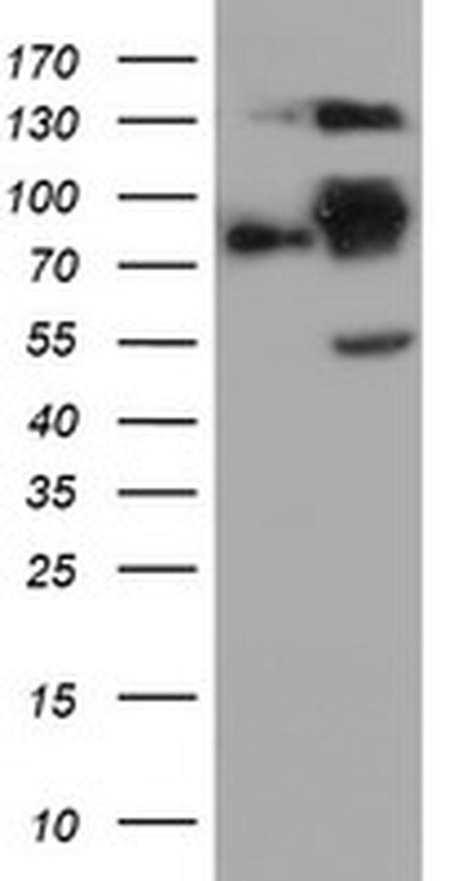 FOLH1 Antibody in Western Blot (WB)