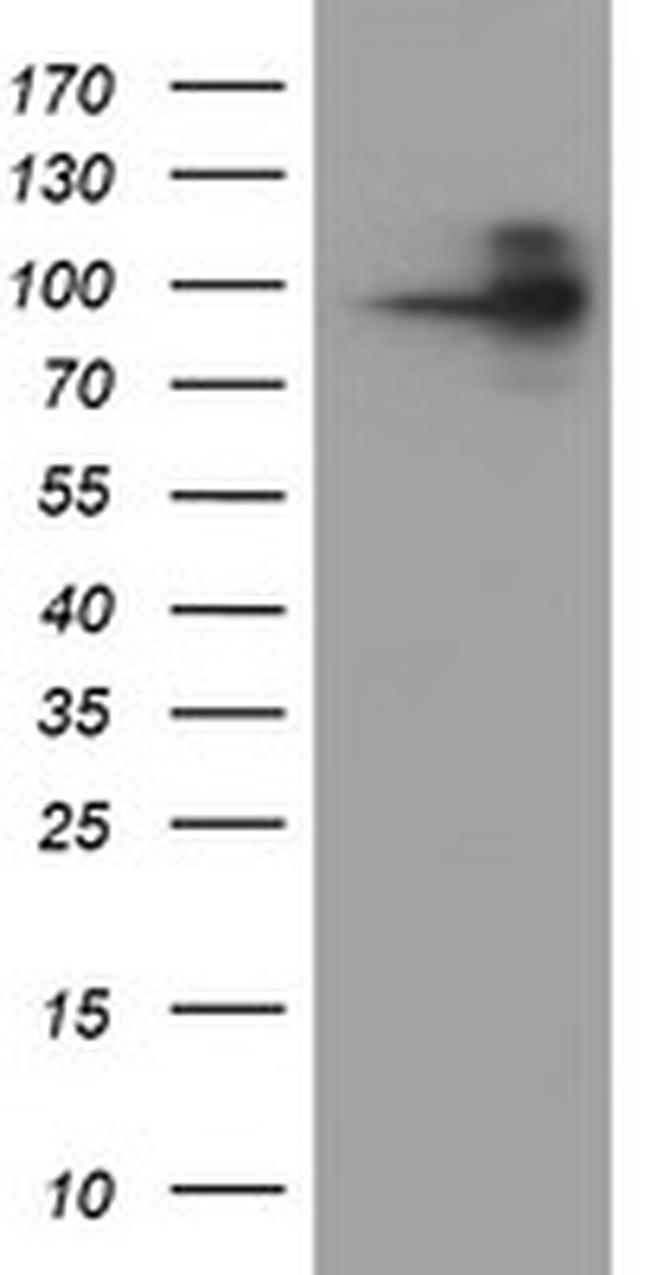 FOLH1 Antibody in Western Blot (WB)