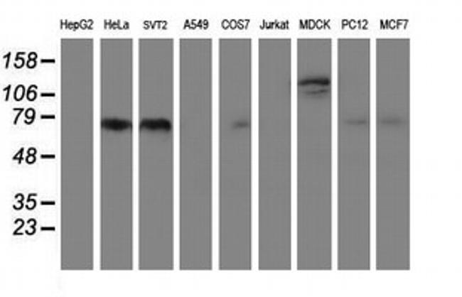 FOLH1 Antibody in Western Blot (WB)