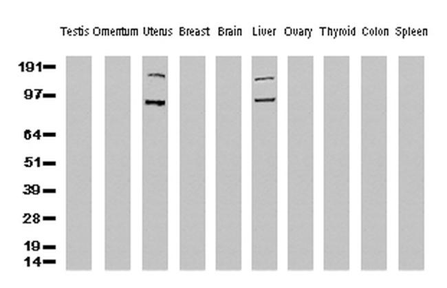 FOLH1 Antibody in Western Blot (WB)