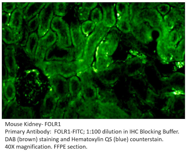 FOLR1 Antibody in Immunohistochemistry (IHC)