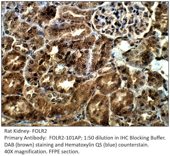 FOLR2 Antibody in Immunohistochemistry (IHC)