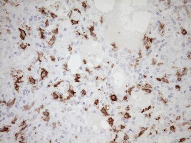 FOLR2 Antibody in Immunohistochemistry (Paraffin) (IHC (P))