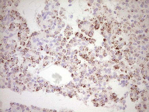 FOS Antibody in Immunohistochemistry (Paraffin) (IHC (P))