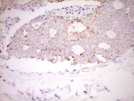 FOS Antibody in Immunohistochemistry (Paraffin) (IHC (P))