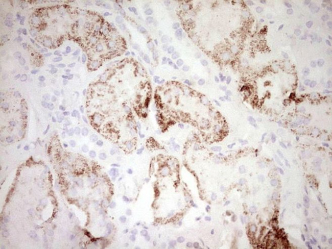 FOS Antibody in Immunohistochemistry (Paraffin) (IHC (P))