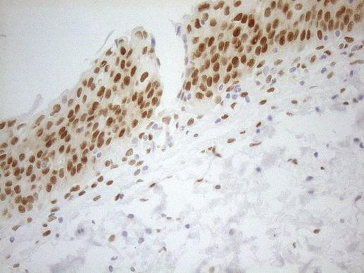 FOS Antibody in Immunohistochemistry (Paraffin) (IHC (P))