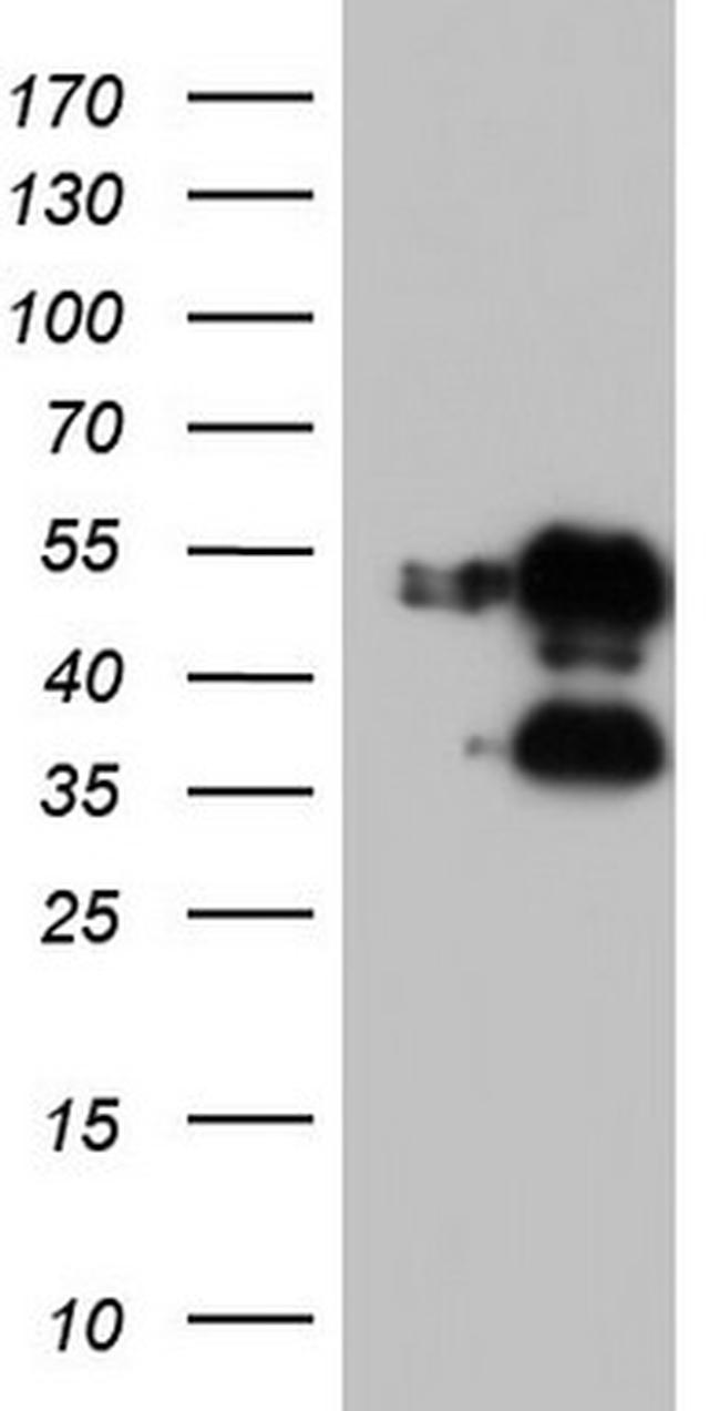 FOSB Antibody in Western Blot (WB)