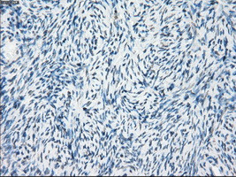 FOSL1 Antibody in Immunohistochemistry (Paraffin) (IHC (P))