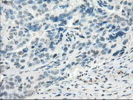 FOSL1 Antibody in Immunohistochemistry (Paraffin) (IHC (P))