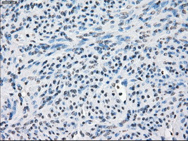 FOSL1 Antibody in Immunohistochemistry (Paraffin) (IHC (P))