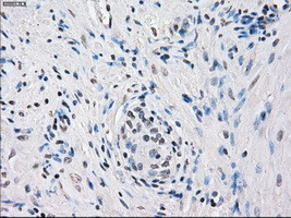 FOSL1 Antibody in Immunohistochemistry (Paraffin) (IHC (P))