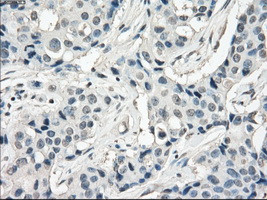 FOSL1 Antibody in Immunohistochemistry (Paraffin) (IHC (P))