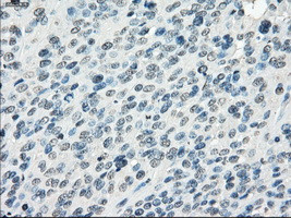 FOSL1 Antibody in Immunohistochemistry (Paraffin) (IHC (P))