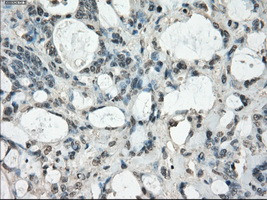 FOSL1 Antibody in Immunohistochemistry (Paraffin) (IHC (P))