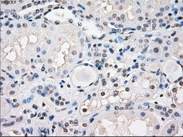 FOSL1 Antibody in Immunohistochemistry (Paraffin) (IHC (P))