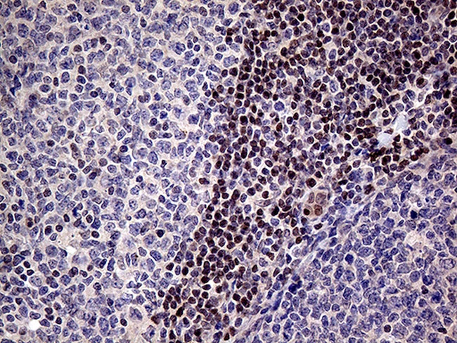 FOSL2 Antibody in Immunohistochemistry (Paraffin) (IHC (P))