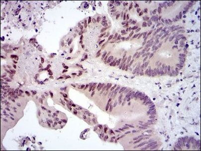 c-Fos Antibody in Immunohistochemistry (Paraffin) (IHC (P))