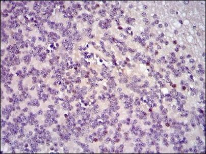 c-Fos Antibody in Immunohistochemistry (Paraffin) (IHC (P))