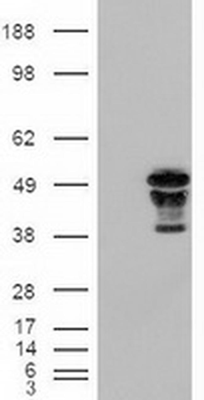 FOXA2 Antibody in Western Blot (WB)