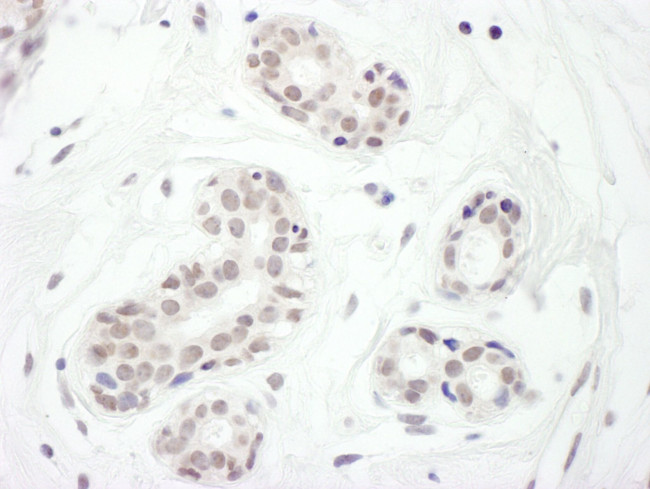 FOXC1 Antibody in Immunohistochemistry (IHC)