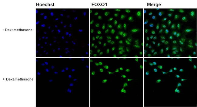 FOXO1 Antibody in Immunocytochemistry (ICC/IF)