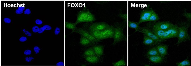 FOXO1 Antibody in Immunocytochemistry (ICC/IF)