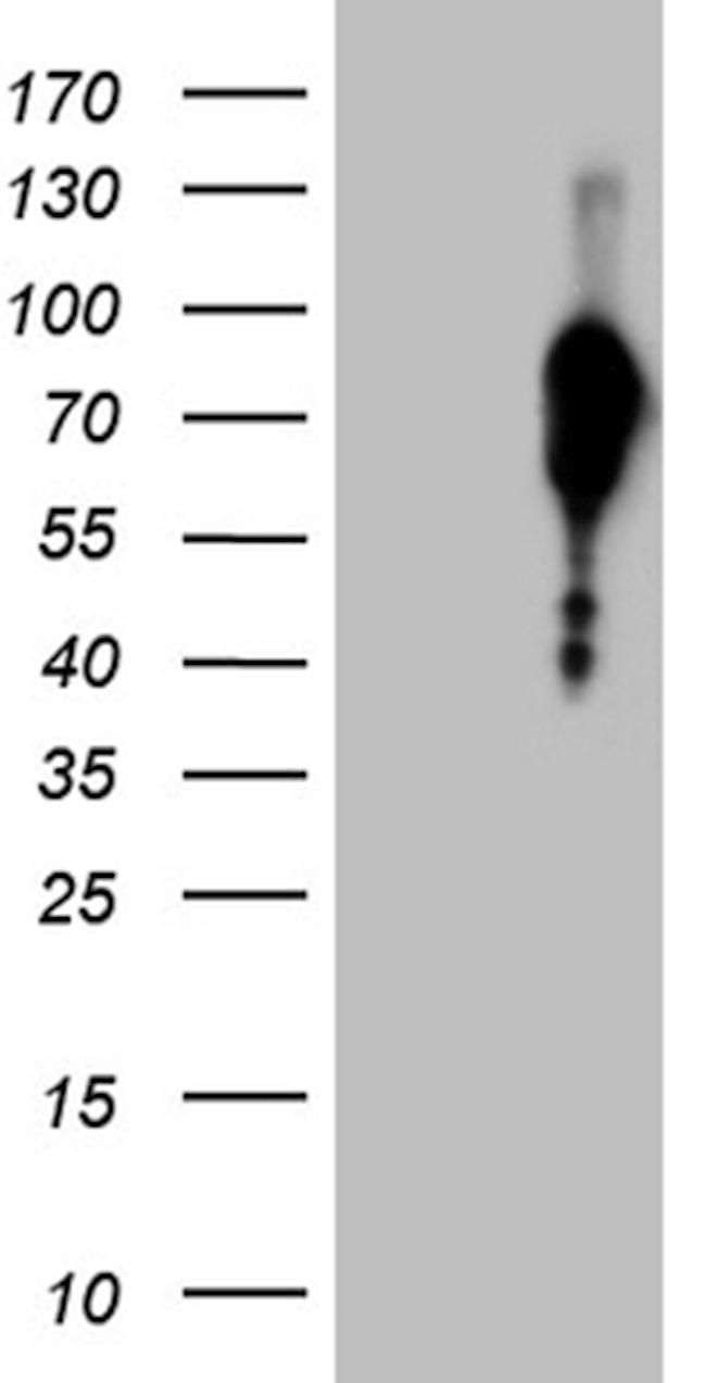 FOXO1 Antibody in Western Blot (WB)