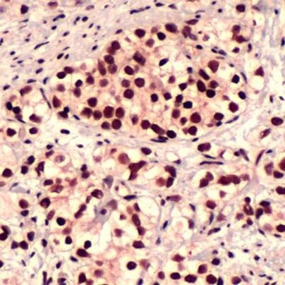 FOXO1 Antibody in Immunohistochemistry (Paraffin) (IHC (P))