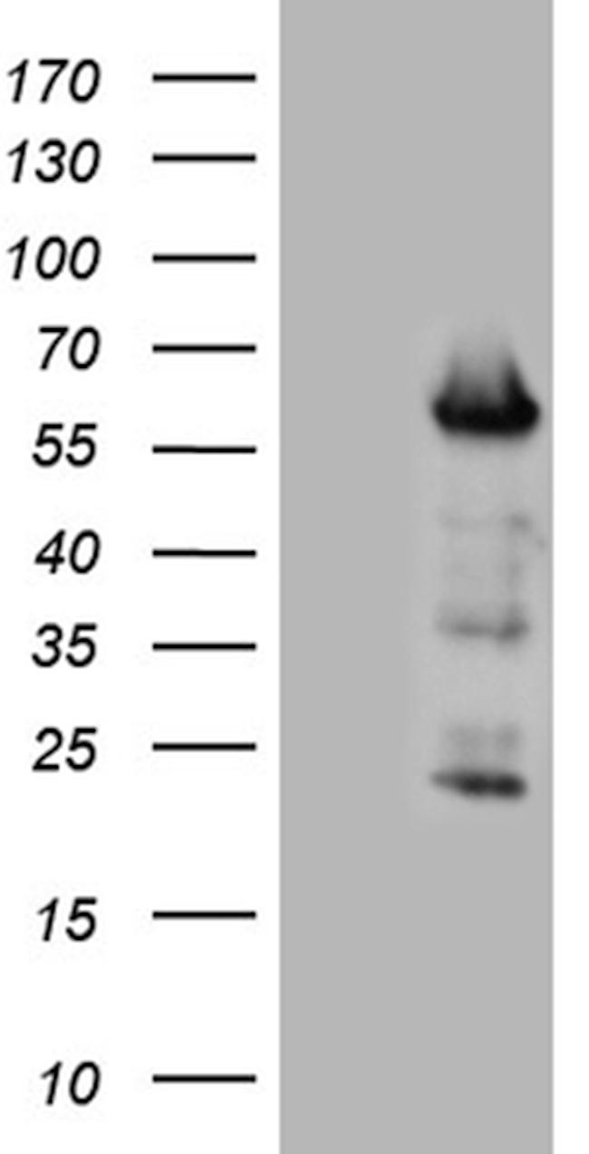 FOXO4 Antibody in Western Blot (WB)