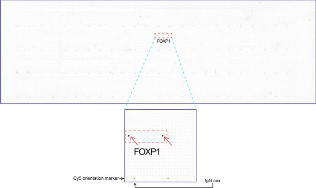 FOXP1 Antibody in Peptide array (ARRAY)