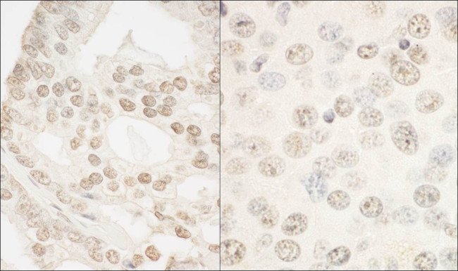 FOXP1 Antibody in Immunohistochemistry (IHC)