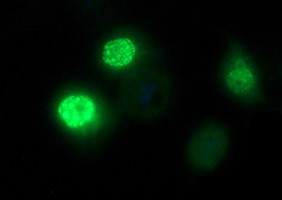 FOXP1 Antibody in Immunocytochemistry (ICC/IF)