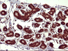 FOXP1 Antibody in Immunohistochemistry (Paraffin) (IHC (P))