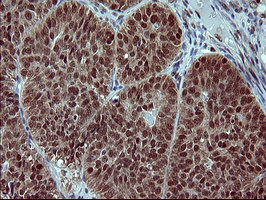 FOXP1 Antibody in Immunohistochemistry (Paraffin) (IHC (P))