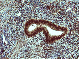 FOXP1 Antibody in Immunohistochemistry (Paraffin) (IHC (P))