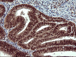 FOXP1 Antibody in Immunohistochemistry (Paraffin) (IHC (P))