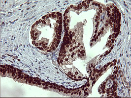 FOXP1 Antibody in Immunohistochemistry (Paraffin) (IHC (P))