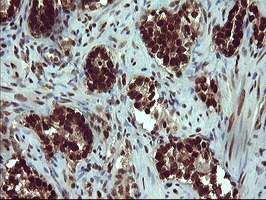 FOXP1 Antibody in Immunohistochemistry (Paraffin) (IHC (P))