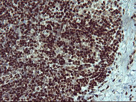 FOXP1 Antibody in Immunohistochemistry (Paraffin) (IHC (P))